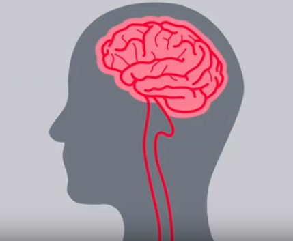 People Affected by Stroke Urged to take Part in Survey