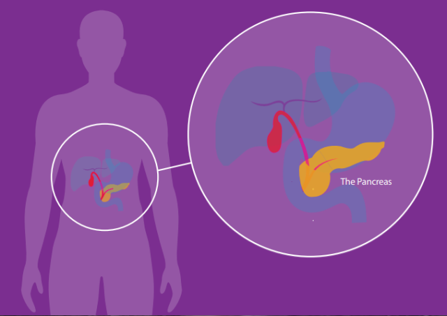 Pancreatic Cancer: The Importance of Early Diagnosis
