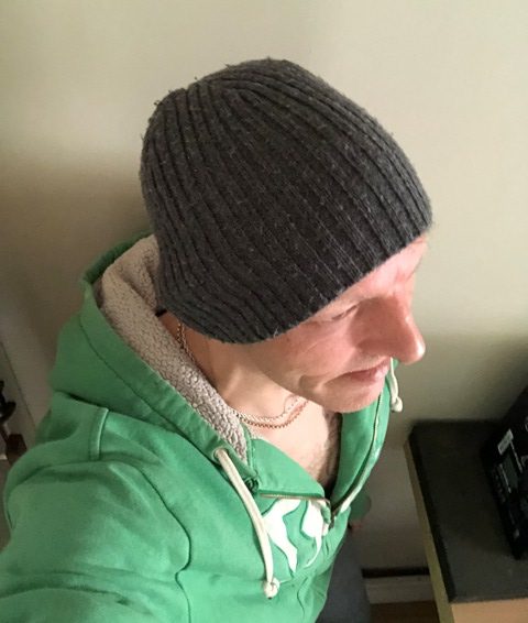 How to survive spinal trauma.