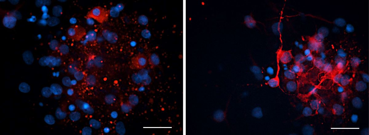New Research: Vitamin A Can Protect Cells Damaged by Diseases Such as Motor Neuron Disease
