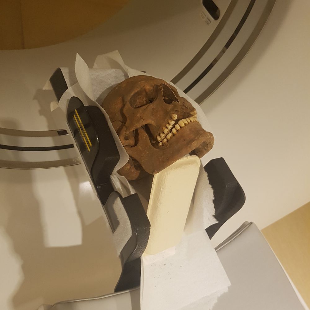 Severe Toothache & Painful Ear Infections Amongst Conditions Vikings Suffered With